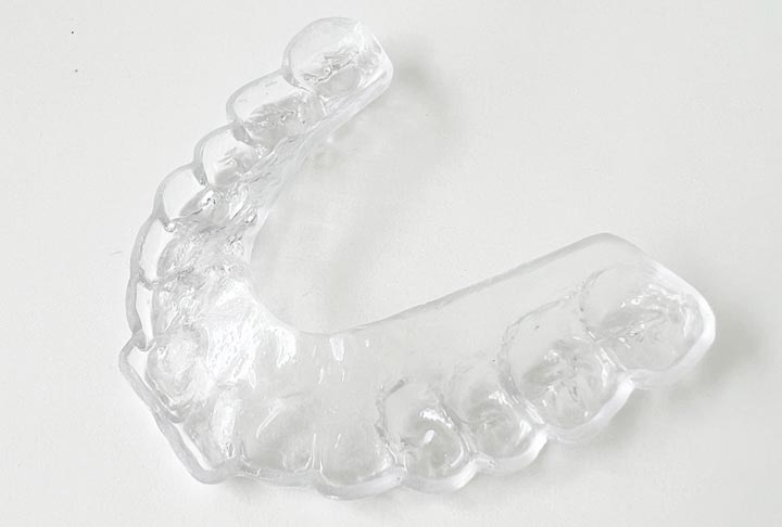 マウスピース治療 | JinMei Dental Clinic